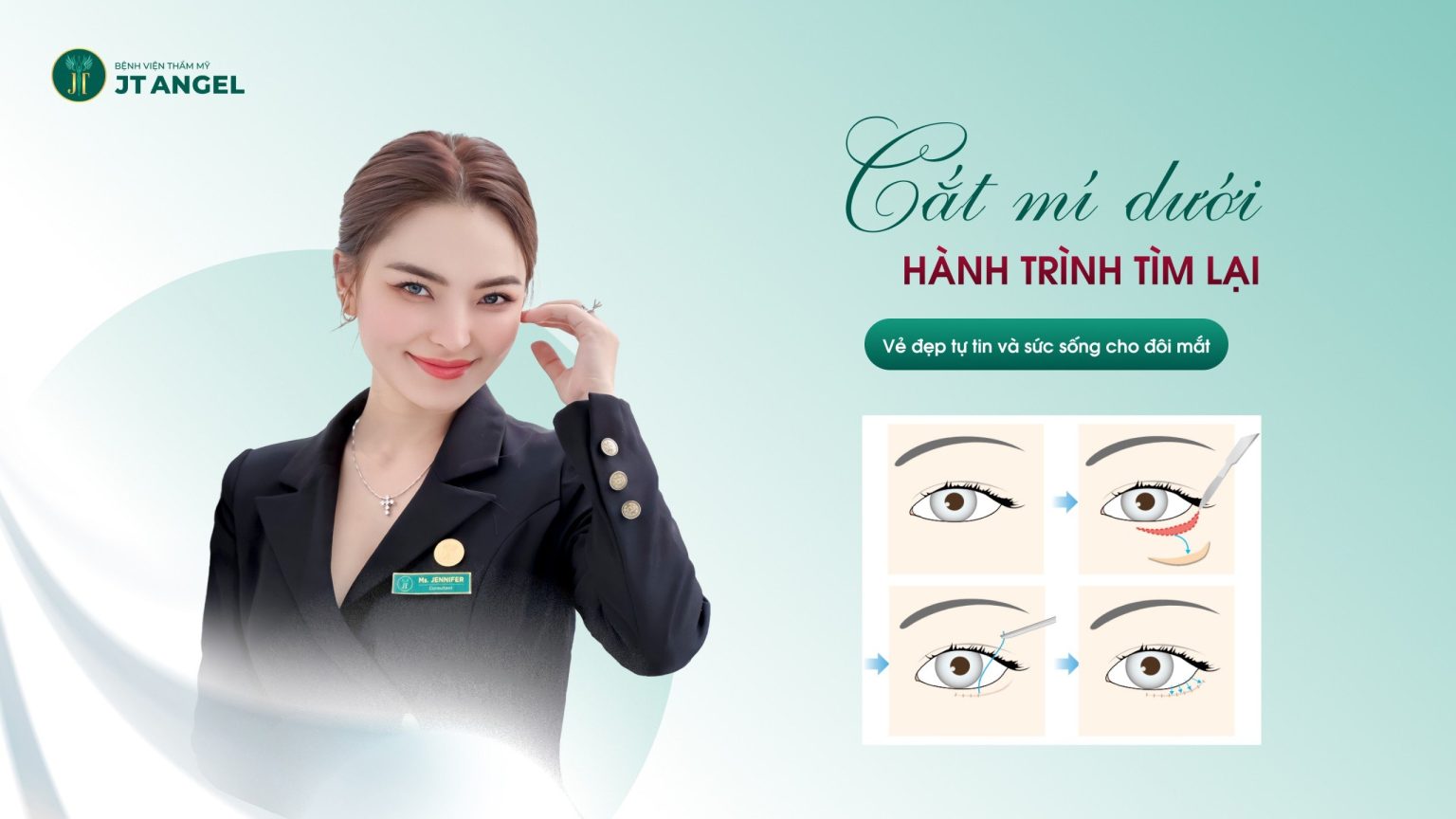 CẮT MÍ DƯỚI: HÀNH TRÌNH TÌM LẠI VẺ ĐẸP TỰ TIN VÀ SỨC SỐNG CHO ĐÔI MẮT